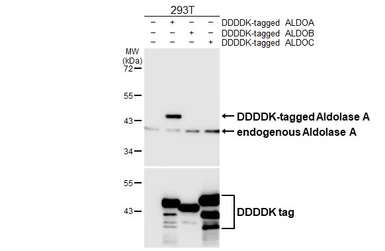 Anti-Aldolase A antibody [HL6304] used in Western Blot (WB). GTX648406