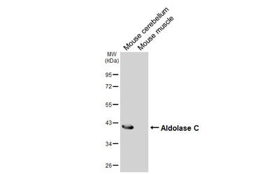 Anti-Aldolase C antibody [HL6306] used in Western Blot (WB). GTX648408