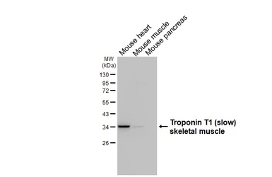 Anti-Troponin T1 (slow) skeletal muscle antibody [HL6319] used in Western Blot (WB). GTX648429