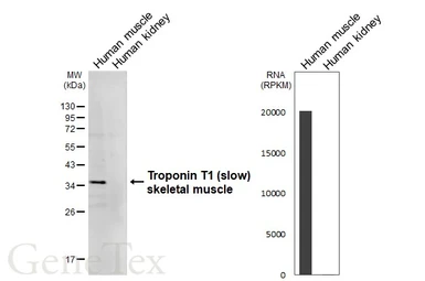 Anti-Troponin T1 (slow) skeletal muscle antibody [HL6319] used in Western Blot (WB). GTX648429