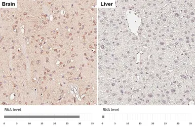 Anti-APC antibody [HL6321] used in IHC (Paraffin sections) (IHC-P). GTX648431