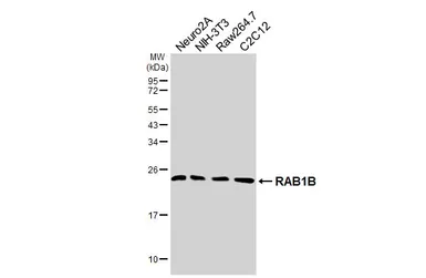Anti-RAB1B antibody [HL6331] used in Western Blot (WB). GTX648441
