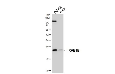 Anti-RAB1B antibody [HL6331] used in Western Blot (WB). GTX648441