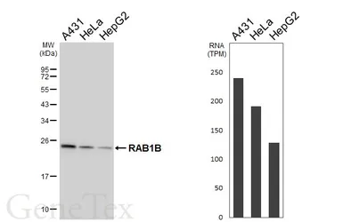 Anti-RAB1B antibody [HL6331] used in Western Blot (WB). GTX648441