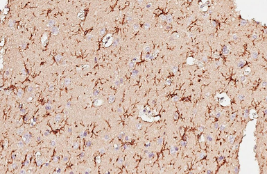 Anti-CD64 antibody [HL6338] used in IHC (Paraffin sections) (IHC-P). GTX648448