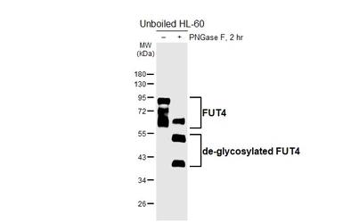 Anti-FUT4 antibody [HL6347] used in Western Blot (WB). GTX648457