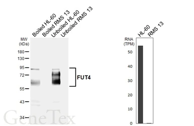 Anti-FUT4 antibody [HL6347] used in Western Blot (WB). GTX648457