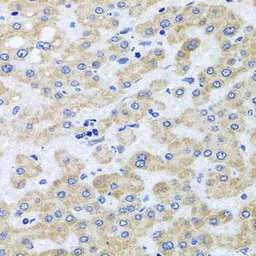 Anti-PEX3 antibody used in IHC (Paraffin sections) (IHC-P). GTX64847