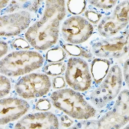 Anti-RBBP9 antibody used in IHC (Paraffin sections) (IHC-P). GTX64865