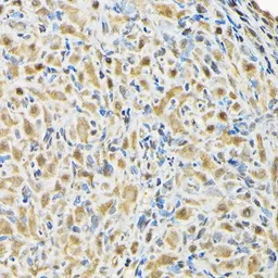 Anti-RBBP9 antibody used in IHC (Paraffin sections) (IHC-P). GTX64865