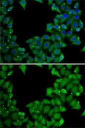 Anti-Rhotekin antibody used in Immunocytochemistry/ Immunofluorescence (ICC/IF). GTX64868