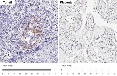 Anti-CD23 antibody [GT413] used in IHC (Paraffin sections) (IHC-P). GTX648783