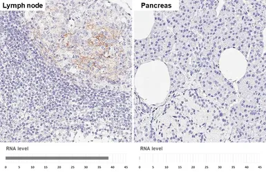 Anti-CD23 antibody [GT413] used in IHC (Paraffin sections) (IHC-P). GTX648783