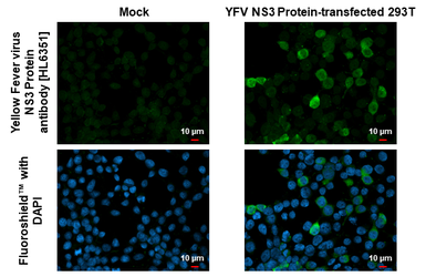 Anti-Yellow Fever virus NS3 Protein antibody [HL6351] used in Immunocytochemistry/ Immunofluorescence (ICC/IF). GTX648790
