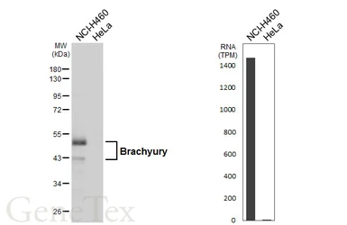Anti-Brachyury antibody [HL6369] used in Western Blot (WB). GTX648808