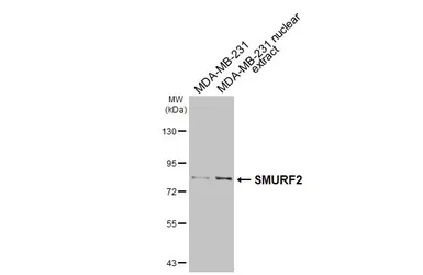 Anti-SMURF2 antibody [HL6373] used in Western Blot (WB). GTX648812
