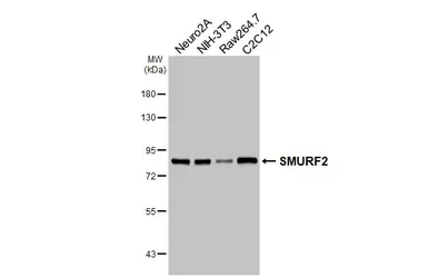 Anti-SMURF2 antibody [HL6373] used in Western Blot (WB). GTX648812