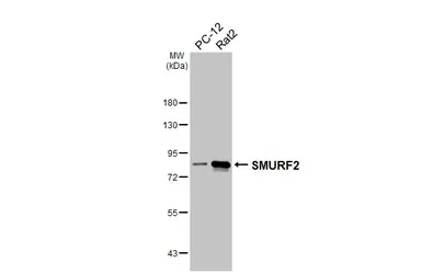Anti-SMURF2 antibody [HL6373] used in Western Blot (WB). GTX648812