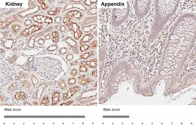 Anti-ACE antibody [HL6377] used in IHC (Paraffin sections) (IHC-P). GTX648816