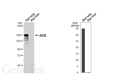 Anti-ACE antibody [HL6377] used in Western Blot (WB). GTX648816