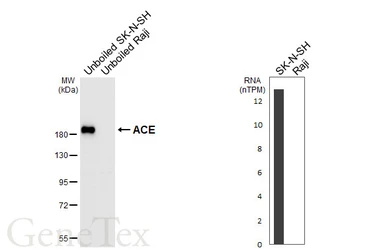 Anti-ACE antibody [HL6377] used in Western Blot (WB). GTX648816