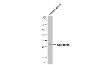 Anti-Calretinin antibody [HL6379] used in Western Blot (WB). GTX648818