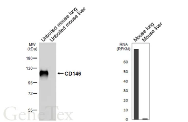 Anti-CD146 antibody [HL6385] used in Western Blot (WB). GTX648824