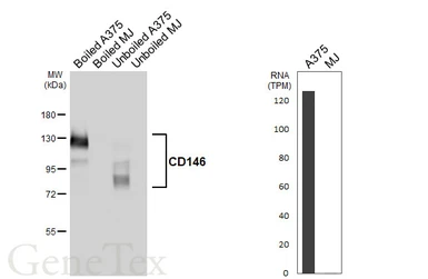 Anti-CD146 antibody [HL6385] used in Western Blot (WB). GTX648824