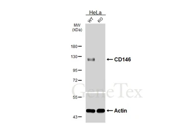 Anti-CD146 antibody [HL6385] used in Western Blot (WB). GTX648824