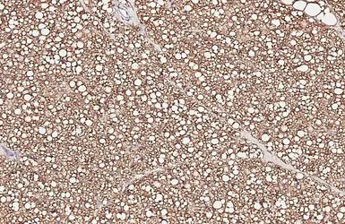 Anti-HSL antibody [HL6391] used in IHC (Paraffin sections) (IHC-P). GTX648830