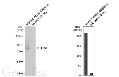 Anti-HSL antibody [HL6391] used in Western Blot (WB). GTX648830