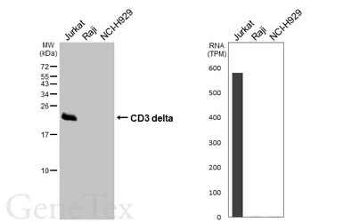 Anti-CD3 delta antibody [GT415] used in Western Blot (WB). GTX648838