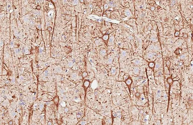 Anti-NF-H antibody [HL6395] used in IHC (Paraffin sections) (IHC-P). GTX648840