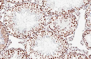 Anti-DDX23 antibody [HL6398] used in IHC (Paraffin sections) (IHC-P). GTX648843