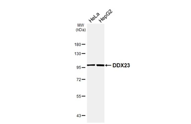 Anti-DDX23 antibody [HL6398] used in Western Blot (WB). GTX648843