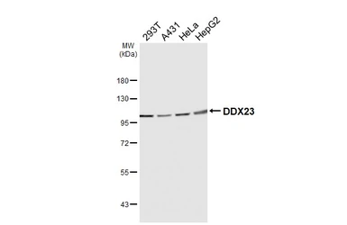 Anti-DDX23 antibody [HL6398] used in Western Blot (WB). GTX648843