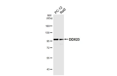 Anti-DDX23 antibody [HL6398] used in Western Blot (WB). GTX648843