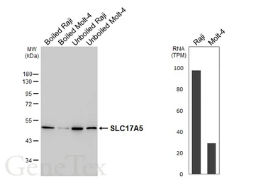 Anti-SLC17A5 antibody [HL6399] used in Western Blot (WB). GTX648844