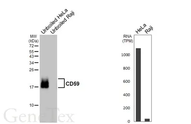 Anti-CD59 antibody [HL6401] used in Western Blot (WB). GTX648846
