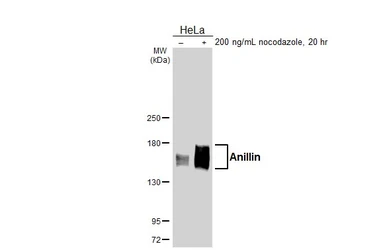 Anti-Anillin antibody [HL6408] used in Western Blot (WB). GTX648853