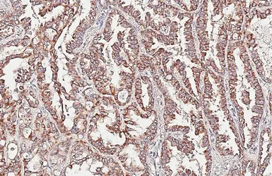 Anti-ALK antibody [HL6409] used in IHC (Paraffin sections) (IHC-P). GTX648854