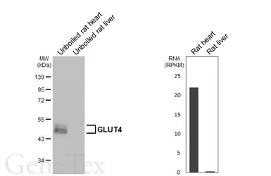 Anti-GLUT4 antibody [HL6419] used in Western Blot (WB). GTX648864