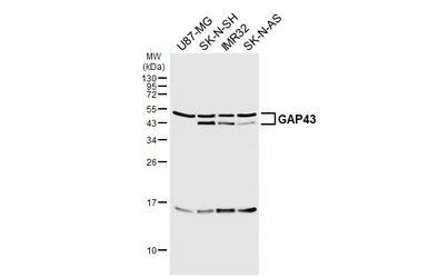 Anti-GAP43 antibody [HL6432] used in Western Blot (WB). GTX648877