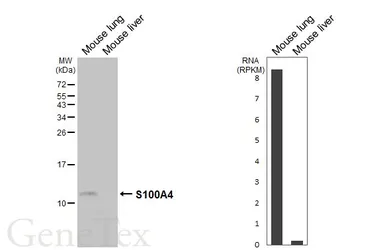 Anti-S100A4 antibody [HL6435] used in Western Blot (WB). GTX648880