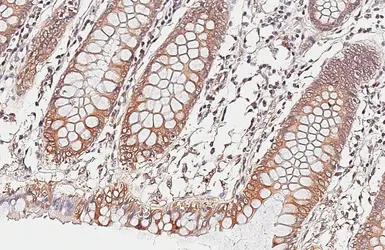 Anti-ACSL5 antibody [HL6450] used in IHC (Paraffin sections) (IHC-P). GTX648898