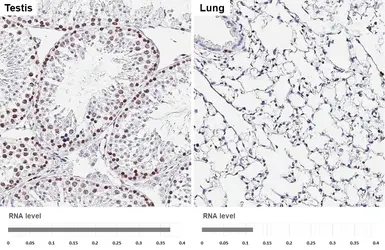 Anti-Ki67 antibody [HL6451] used in IHC (Paraffin sections) (IHC-P). GTX648899