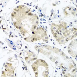 Anti-PCBP1 antibody used in IHC (Paraffin sections) (IHC-P). GTX64891