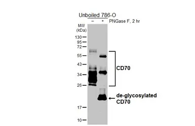 Anti-CD70 antibody [HL6469] used in Western Blot (WB). GTX648917