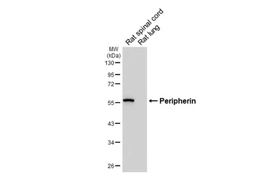 Anti-Peripherin antibody [HL6471] used in Western Blot (WB). GTX648919