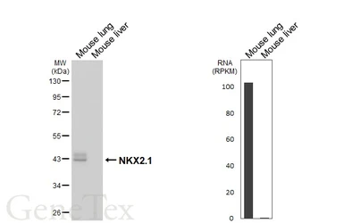 Anti-NKX2.1 antibody [HL6474] used in Western Blot (WB). GTX648922
